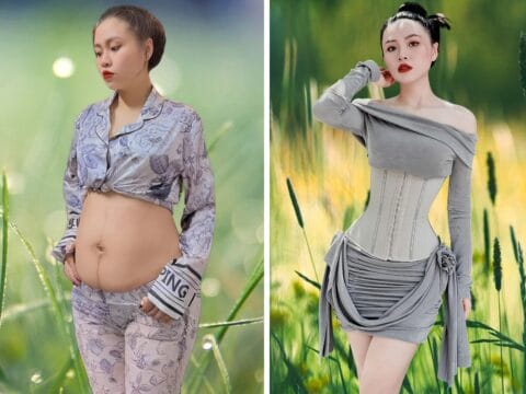 Nịt Bụng Có Giúp Giảm Eo Sau Sinh Không?